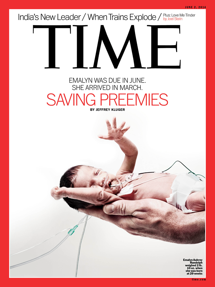 famous premature babies
